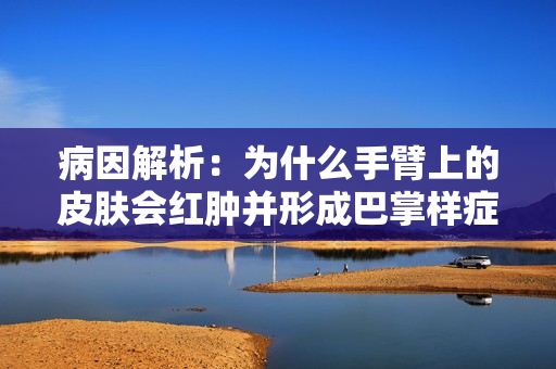 病因解析：为什么手臂上的皮肤会红肿并形成巴掌样症状？